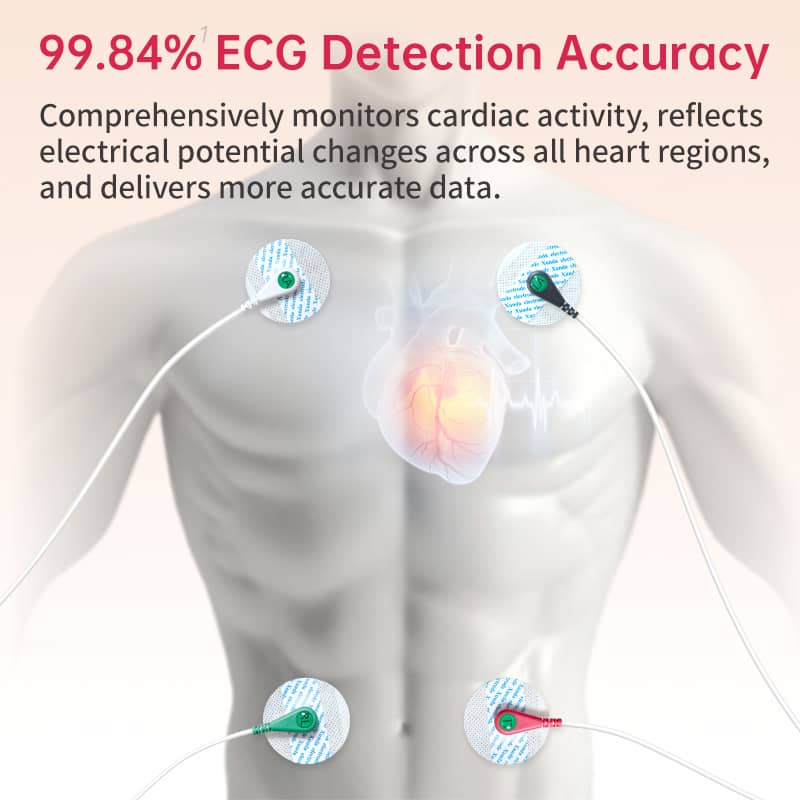 MULTI-Lead ECG Monitoring  Blood Glucose Blood Pressure Heart Rate Measurement Health Smart Watch